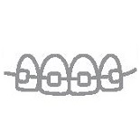 Ortodoncia en Mahon Menorca