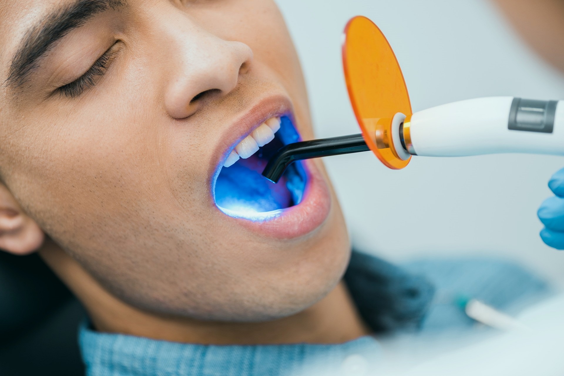 Blanqueamiento dental en Menorca