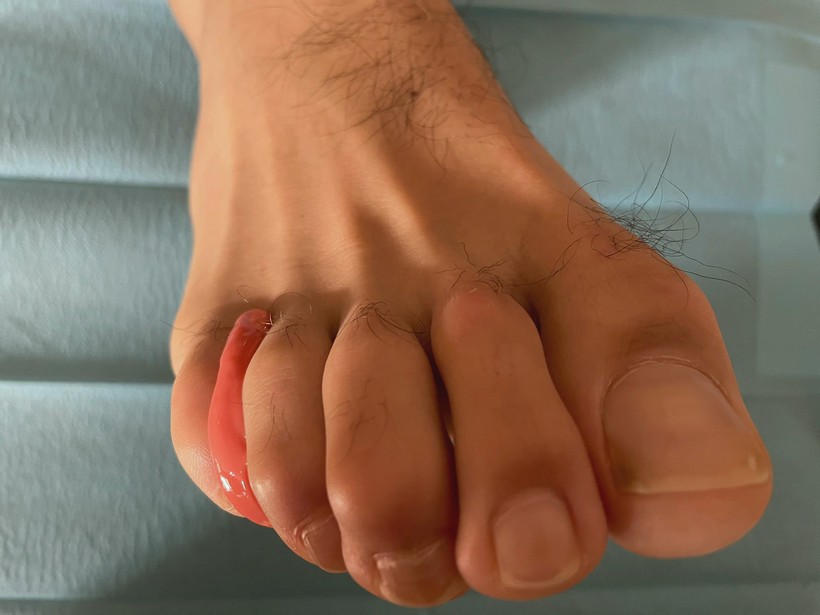 Cuidados de los pies en Menorca