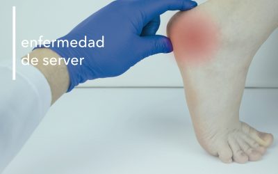 ENFERMEDAD DE SERVER