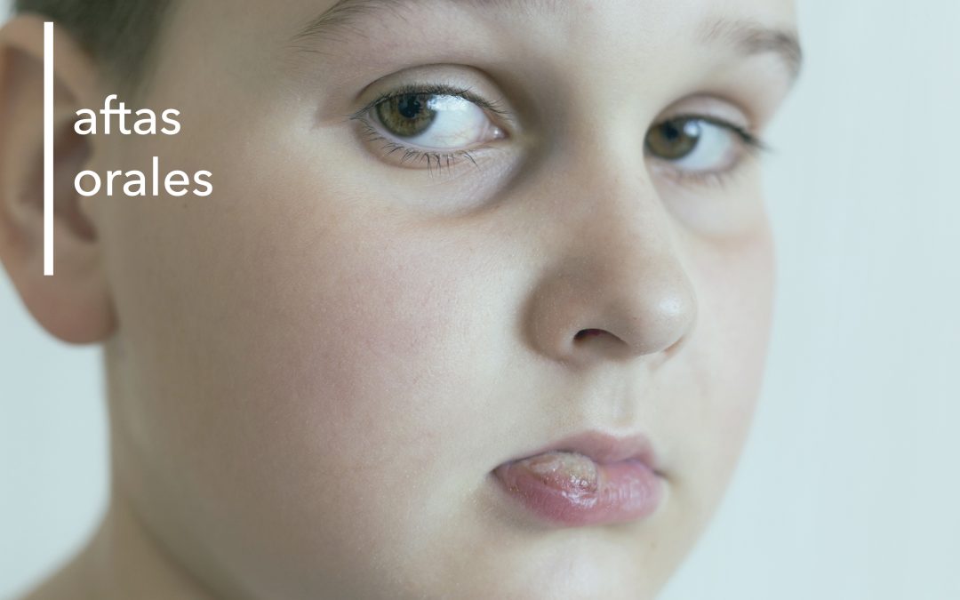 LAS AFTAS ORALES