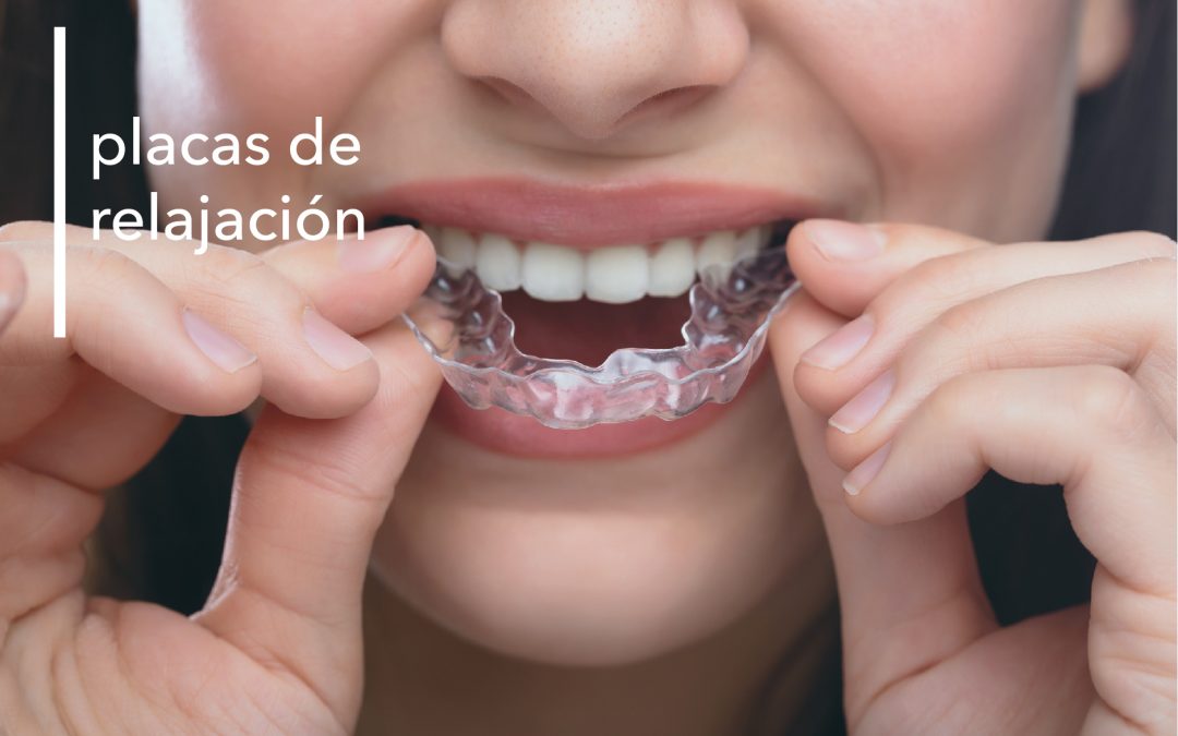 LAS PLACAS DE RELAJACIÓN