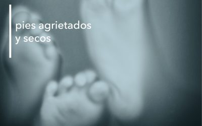 TALONES AGRIETADOS Y SECOS