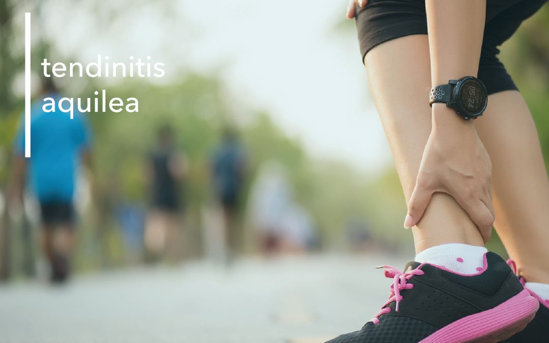 TENDINITIS AQUILEA