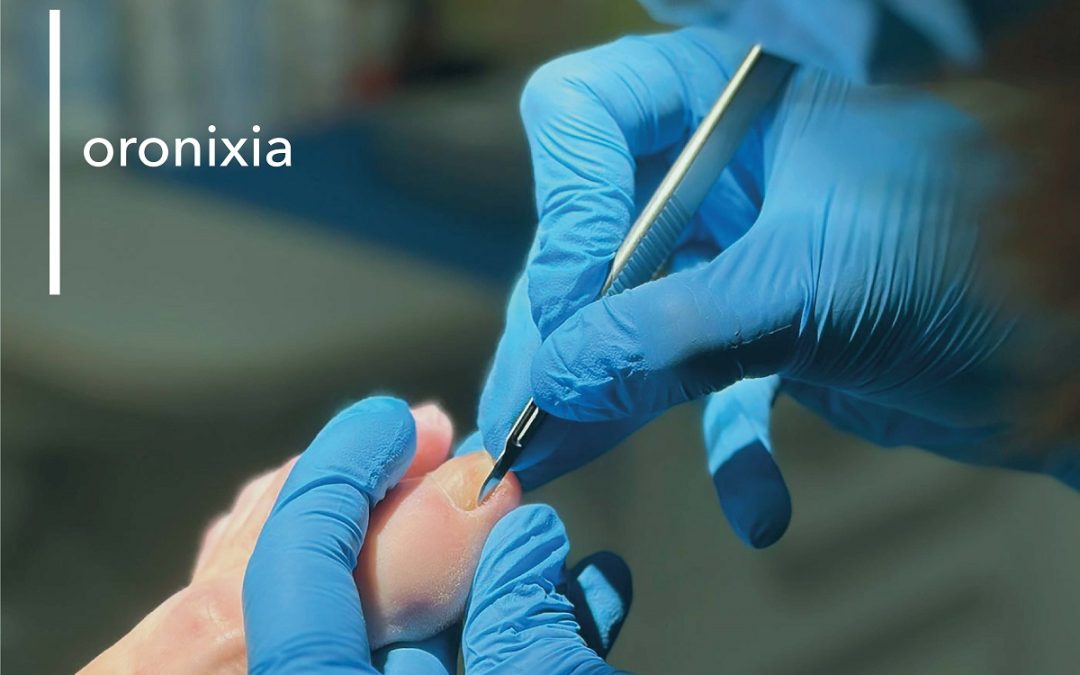 TRATAMIENTO DE ORONIXIA