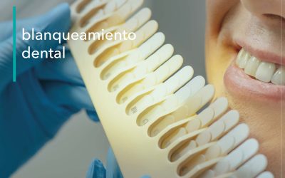 BLANQUEAMIENTO DENTAL