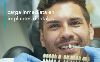 CARGA INMEDIATA EN IMPLANTES DENTALES