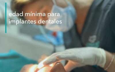 ¿CUÁL ES LA EDAD MÍNIMA PARA COLOCAR IMPLANTES DENTALES?