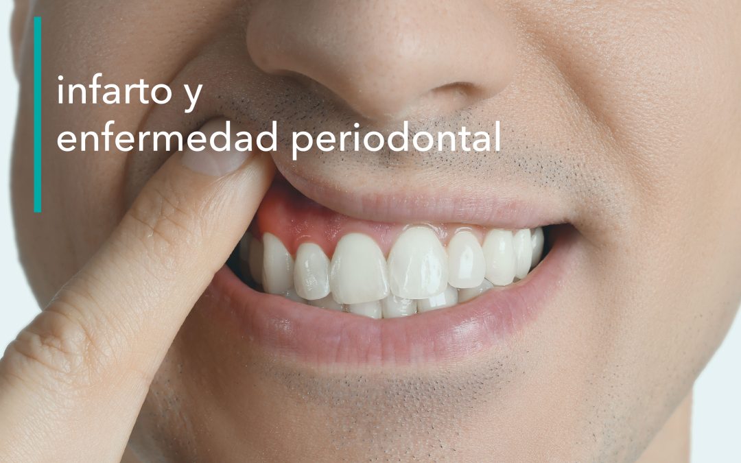 ¿QUÉ RELACIÓN TIENE EL CUIDADO DE LAS ENCÍAS CON LA PROBABILIDAD DE SUFRIR UN INFARTO?