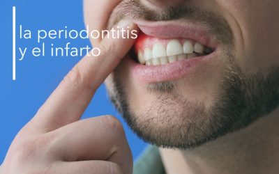 LA RELACIÓN ENTRE LA PERIODONTITIS Y EL INFARTO