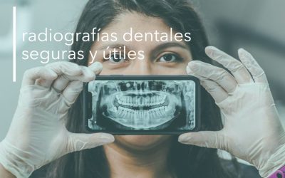 RADIOGRAFÍAS DENTALES: SEGURAS Y ÚTILES.