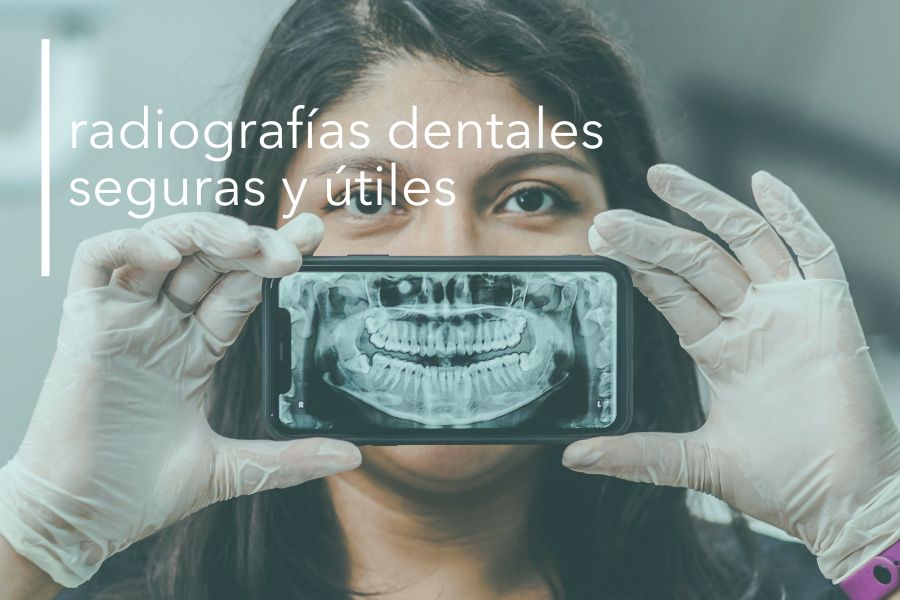 RADIOGRAFÍAS DENTALES: SEGURAS Y ÚTILES.