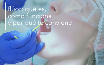 FLÚOR: QUÉ ES, CÓMO FUNCIONA Y POR QUÉ TE CONVIENE.