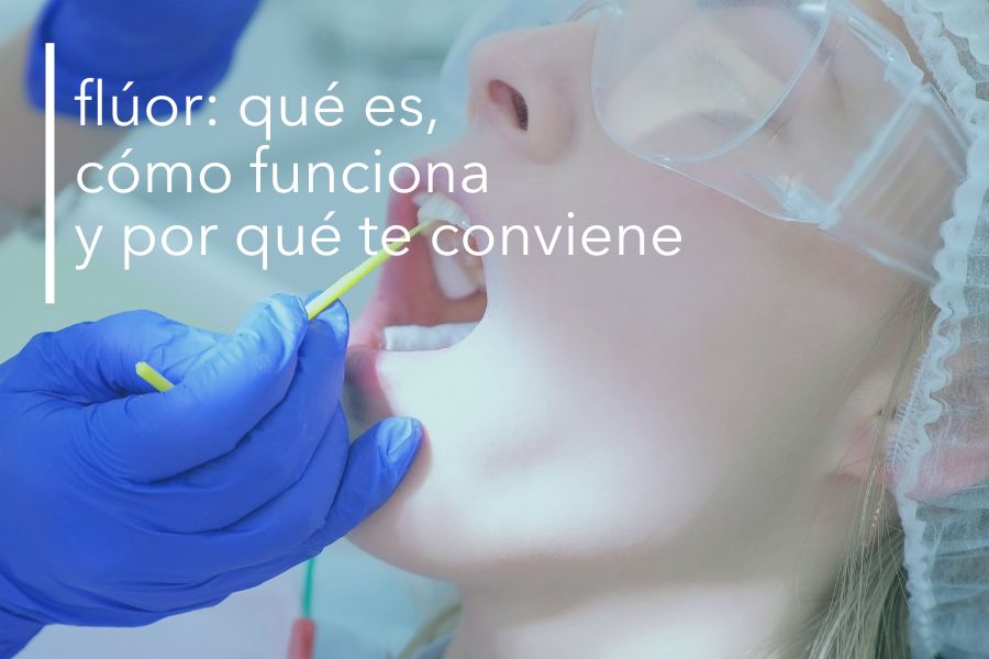 FLÚOR: QUÉ ES, CÓMO FUNCIONA Y POR QUÉ TE CONVIENE.